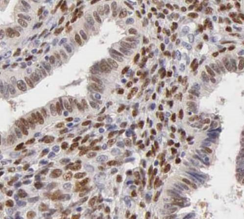 TYMS Antibody