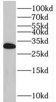 THYN1 Rabbit Polyclonal Antibody