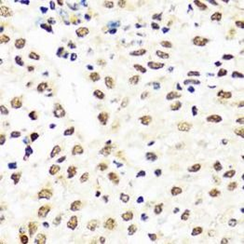 TIA1 Antibody