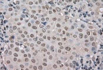 MYO18A Antibody