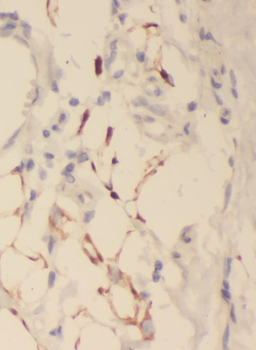 DNAJA3 Antibody