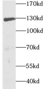 TEK Rabbit Polyclonal Antibody