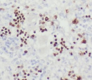TIMELESS Antibody