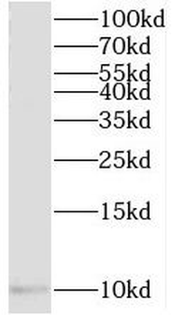 TIMM10 Rabbit Polyclonal Antibody