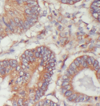 TIMM17B Antibody