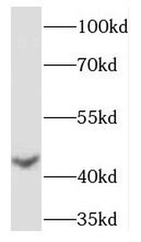 TIMM44 Rabbit Polyclonal Antibody