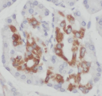 TIMM9 Antibody
