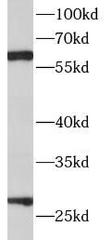 TIMP4 Rabbit Polyclonal Antibody