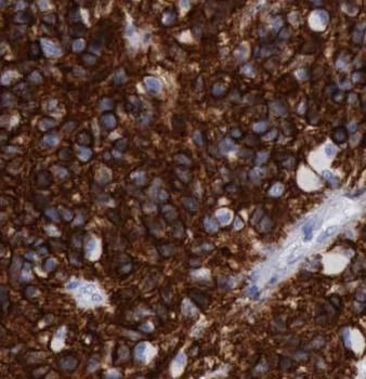 TIMP4 Rabbit Polyclonal Antibody