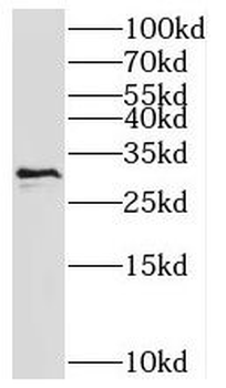HTATIP2 Antibody
