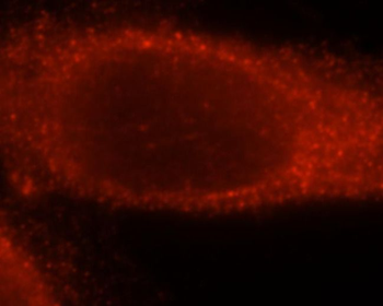 TK1 Antibody