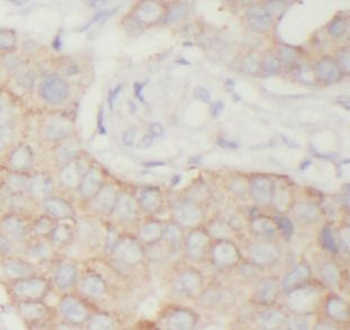 TK1 Antibody