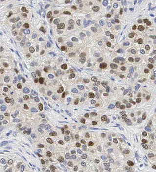 TLE3 Antibody