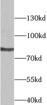TLK2 Antibody
