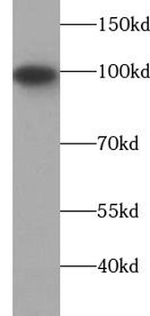 TLR4 Rabbit Polyclonal Antibody