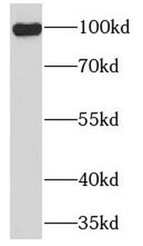 TLR6 Rabbit Polyclonal Antibody