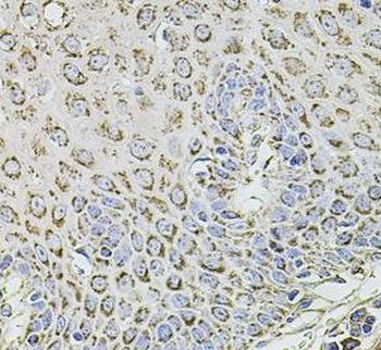 TMC1 Antibody
