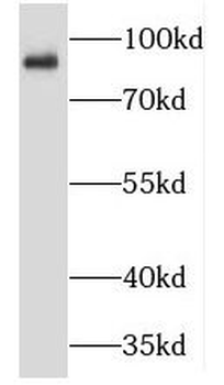 TMCC2 Antibody