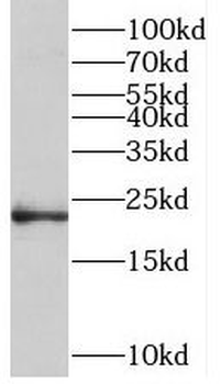 TMEM11 Antibody