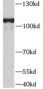 TMEM132A Rabbit Polyclonal Antibody