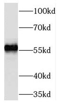TMEM161A Antibody