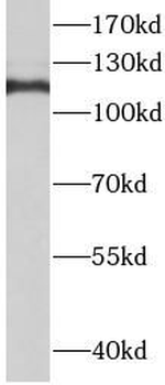 TMEM168 Antibody