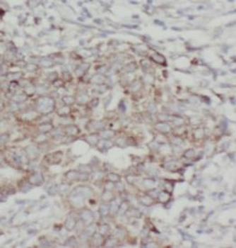 ANO1 Rabbit Polyclonal Antibody