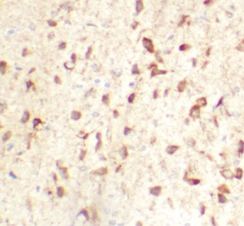 TMEM175 Antibody
