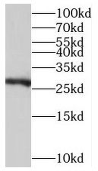 TMEM176A Antibody