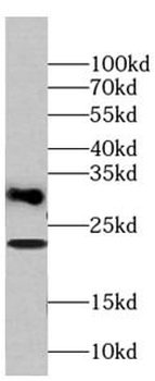 TMEM176B Antibody