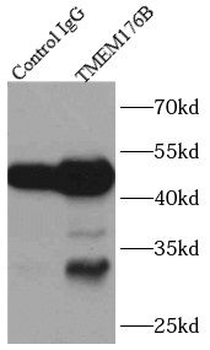 TMEM176B Antibody