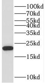 TMEM199 Rabbit Polyclonal Antibody