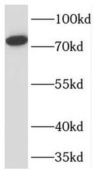 TMEM214 Rabbit Polyclonal Antibody