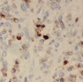 TMEM25 Antibody
