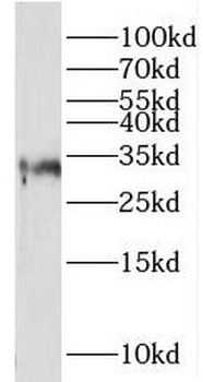 CLTRN Antibody