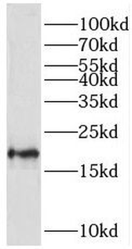 TMEM35A Antibody