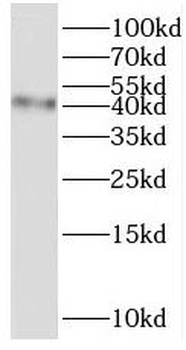 TMEM38B Antibody