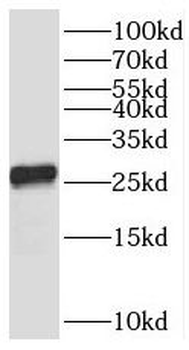 TMEM41A Antibody