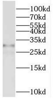 PIP4P1 Antibody