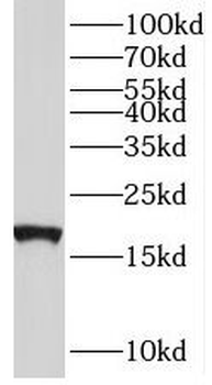 TMEM70 Rabbit Polyclonal Antibody
