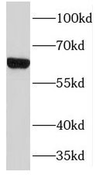 TMEM87A Antibody
