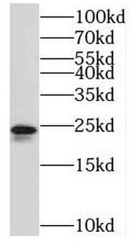 TMEM9 Rabbit Polyclonal Antibody