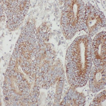 TMF1 Antibody
