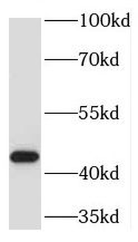TMLHE Antibody