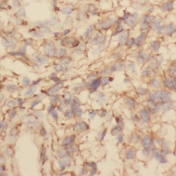 TMOD2 Antibody