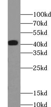 TMOD3 Antibody