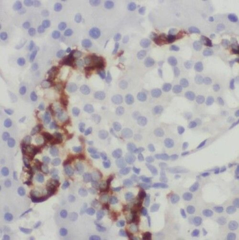 TMED10 Antibody