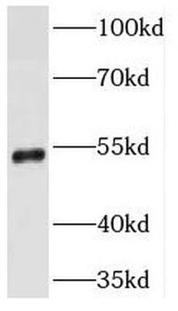 TMPRSS5 Rabbit Polyclonal Antibody