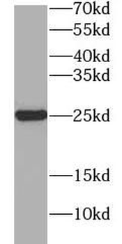 PYCARD Rabbit Polyclonal Antibody