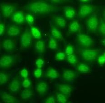 PYCARD Rabbit Polyclonal Antibody